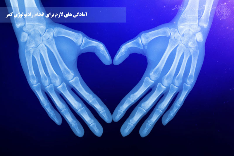 رادیولوژی کمر
