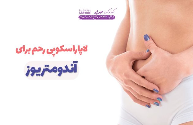 لاپاراسکوپی رحم برای آندومتریوز