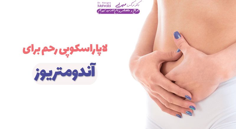 لاپاراسکوپی رحم برای آندومتریوز